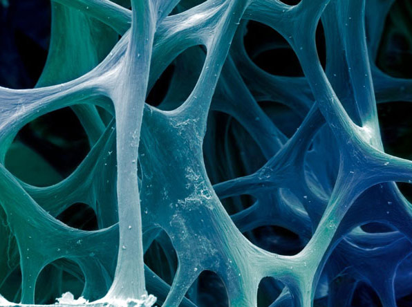 Mikroskopaufnahme von porösem Knochengewebe