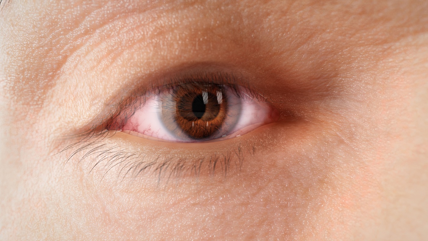 Nahaufnahme eines menschlichen Auges mit brauner Iris. Das Auge zeigt einen unscharfen Doppelbildeffekt.